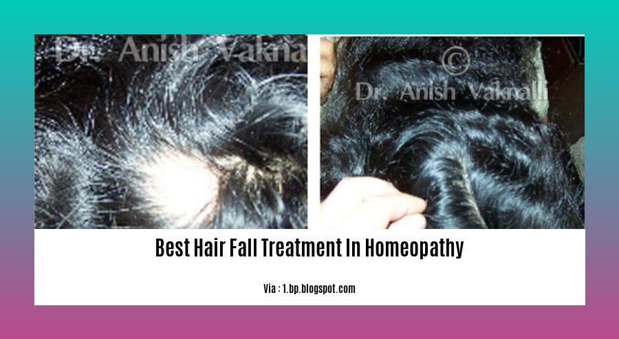 best hair fall treatment in homeopathy