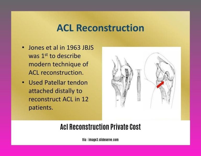  ACL Reconstruction Private Costs An InDepth Analysis Wave Sold