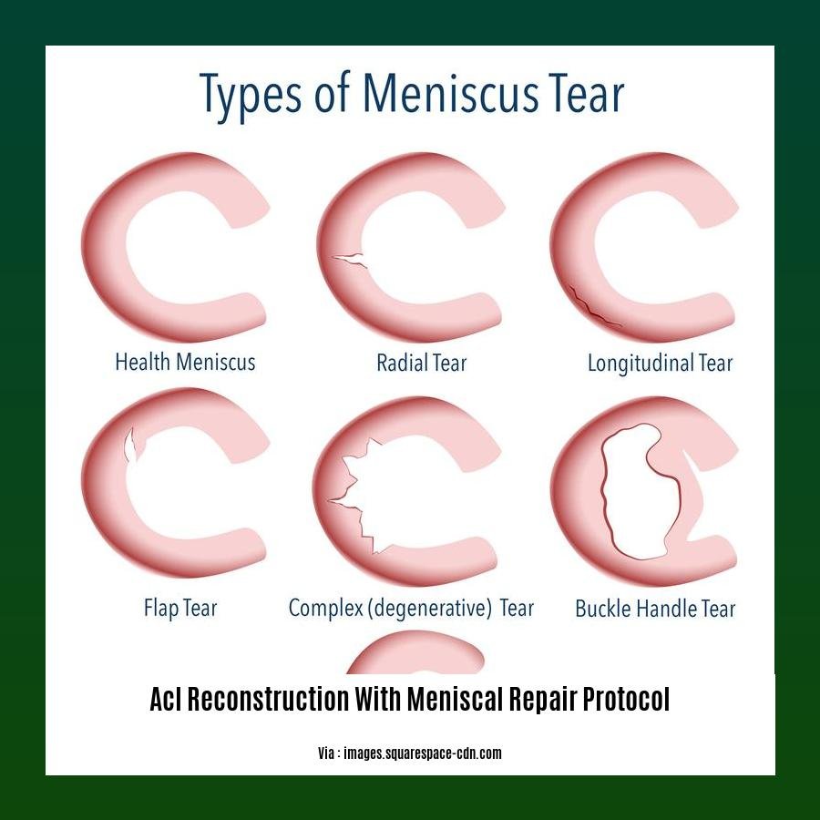 acl reconstruction with meniscal repair protocol