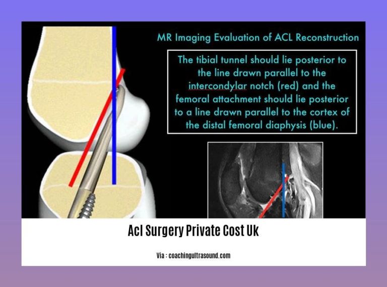 ACL Surgery Private Cost UK: A Comprehensive Guide to Financial ...