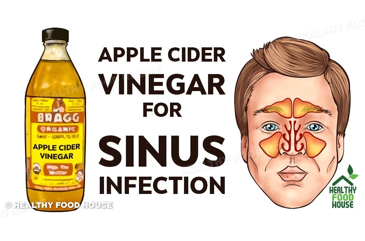 best home remedy for abscess tooth pain