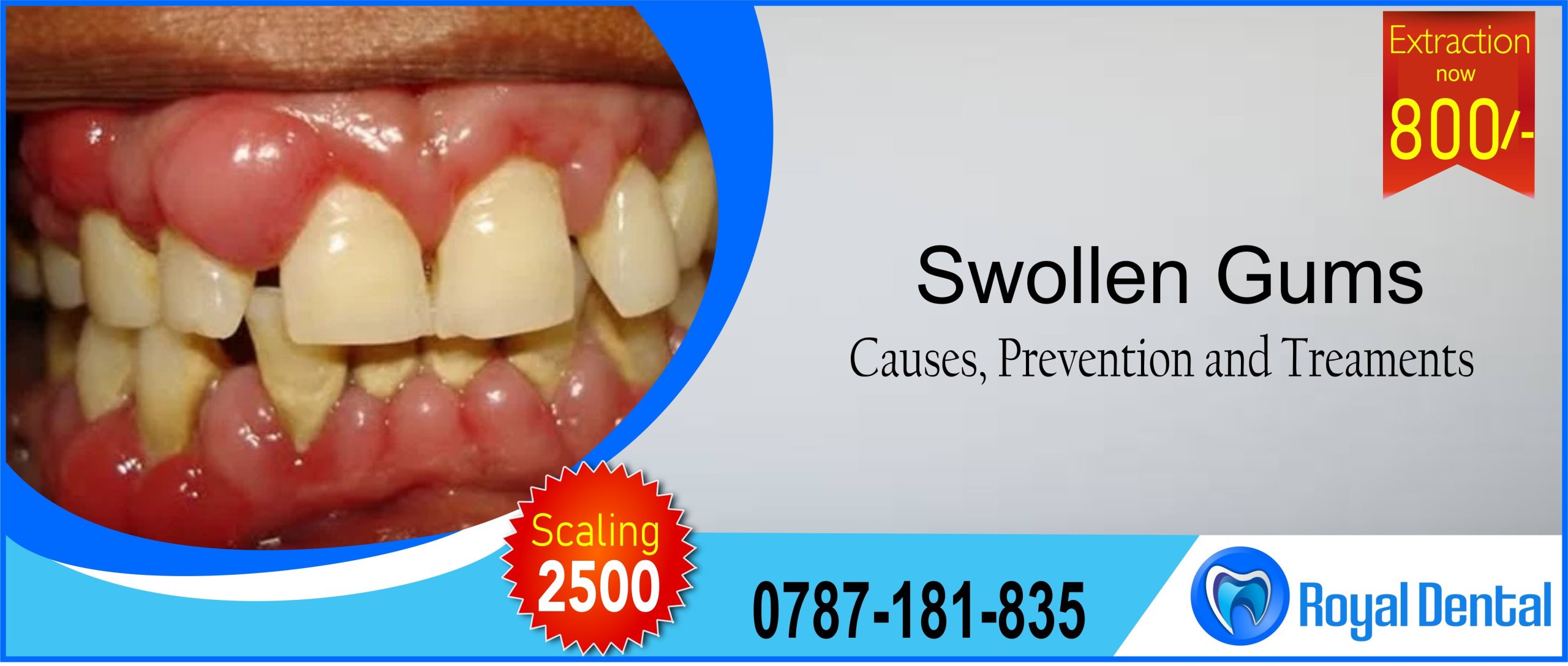 best home remedy for gum infection