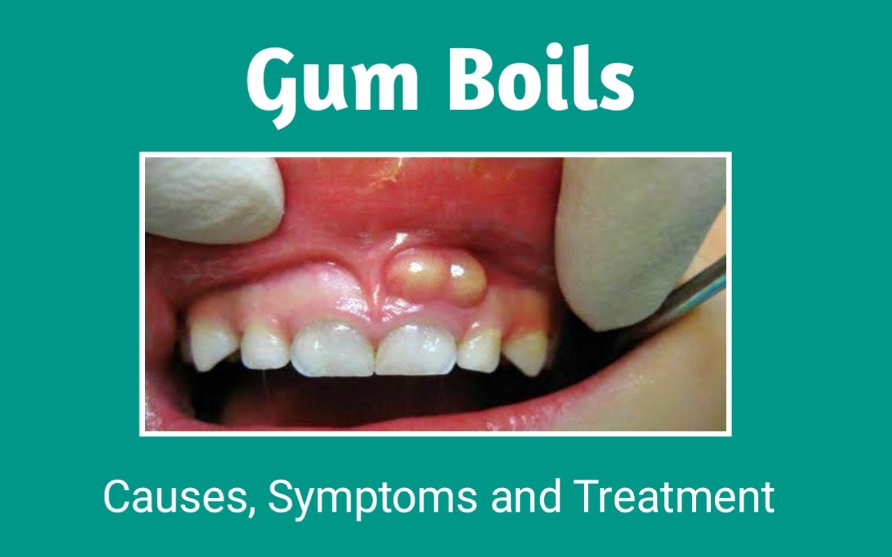 home remedies for sore gums from dentures