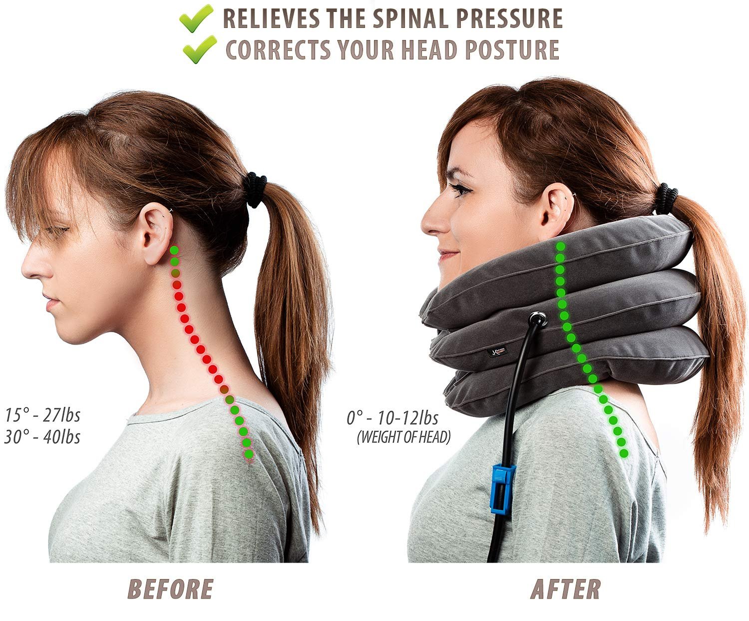 home remedy for pinched nerve in neck