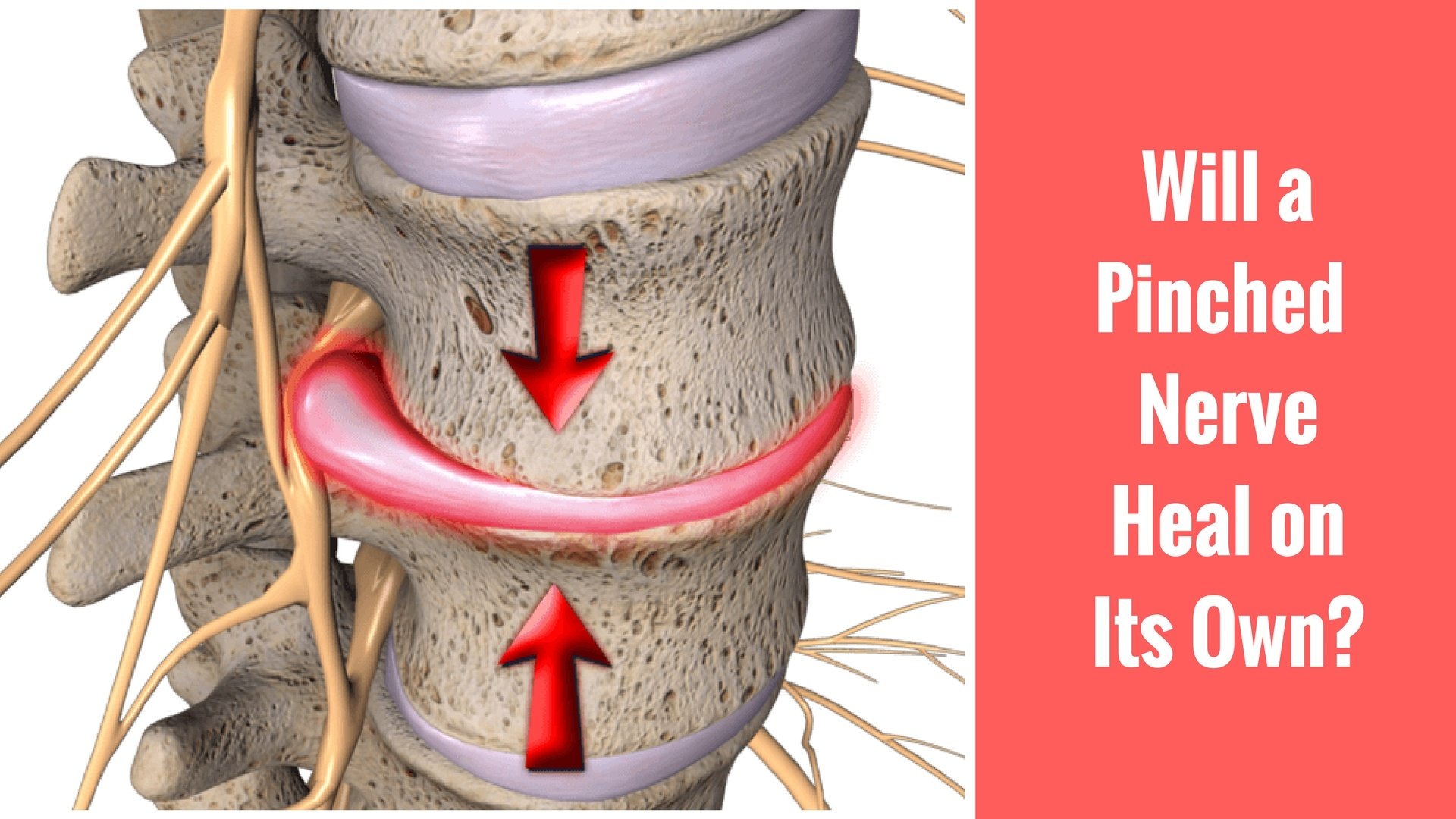 home remedy for pinched nerve in neck