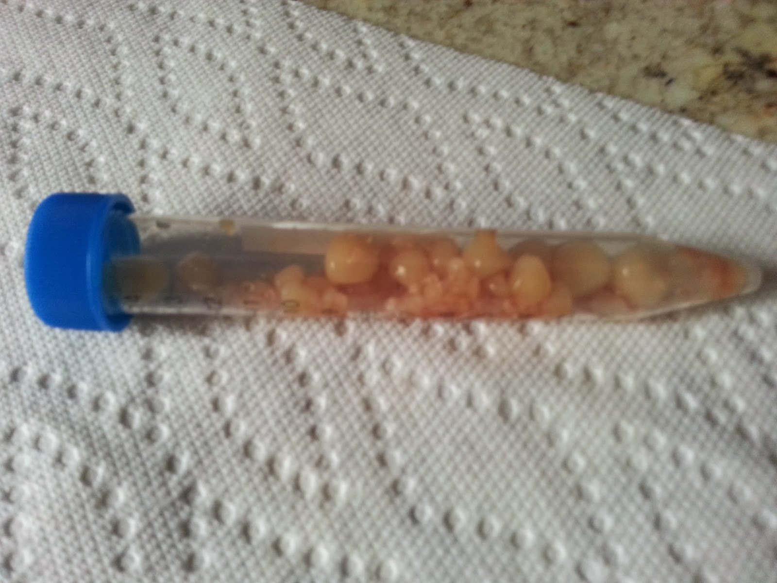 homemade dog food bladder stones